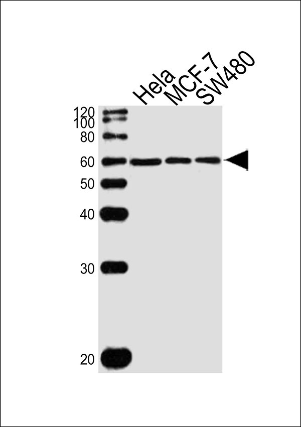WB - KLF4 Antibody (N-term) AW5208-U100